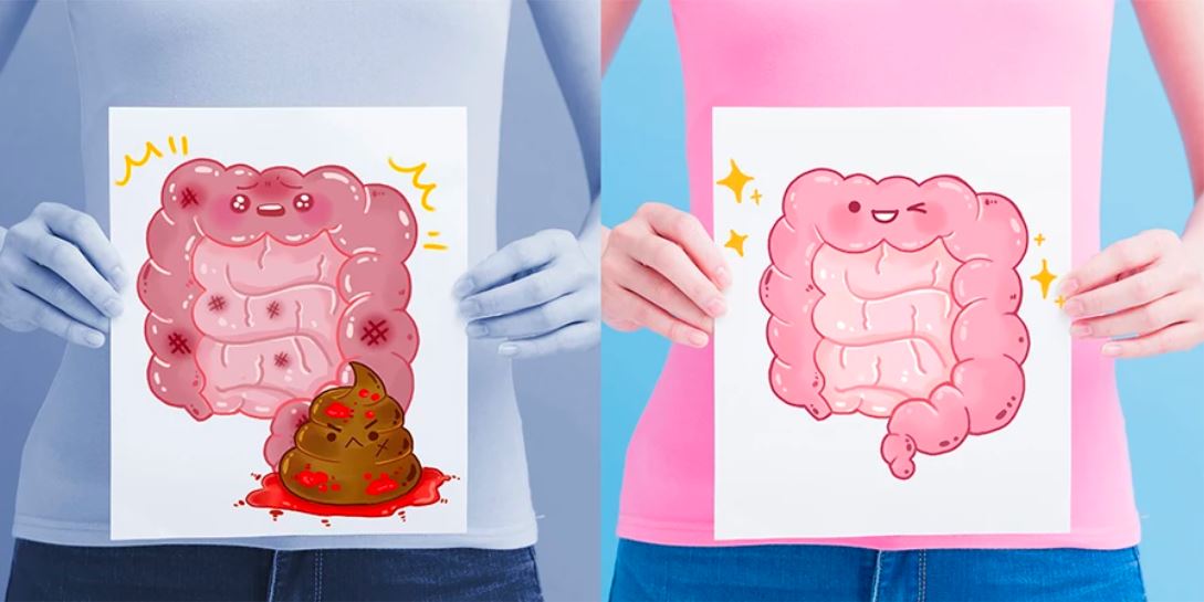 อาหารสำหรับลำไส้ใหญ่ อาหารที่มีพรีไบโอติก อาหารที่มีโปรไบโอติก