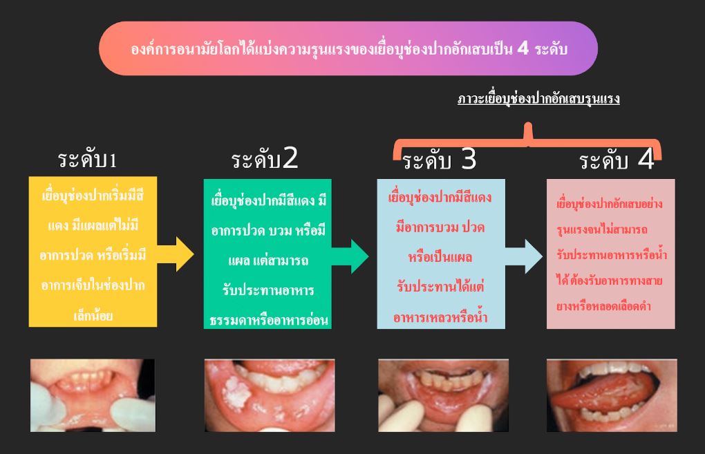 ภาวะเยื่อบุช่องปากอักเสบ 8